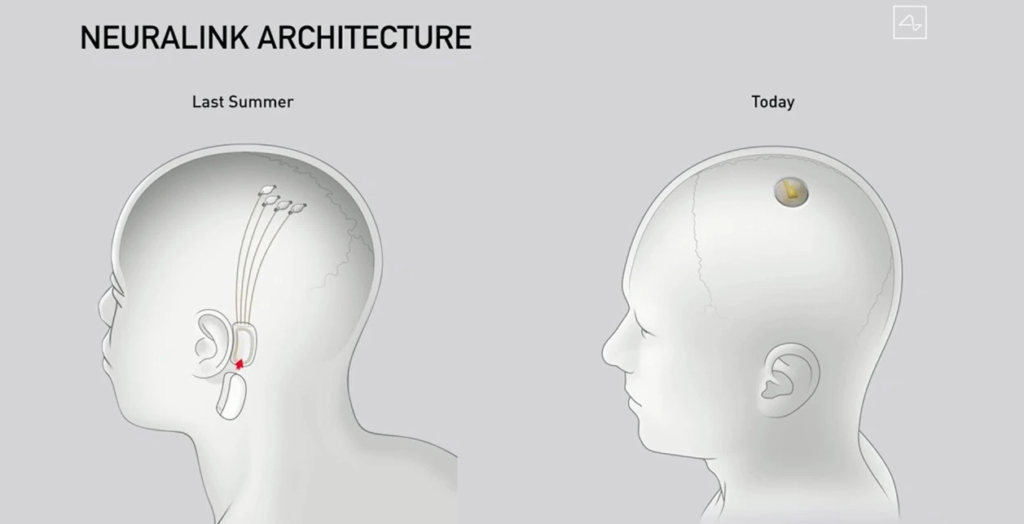 Elon Musk giver svin mikrochip i hjernen – næste skridt er mennesker 2 Neuralink