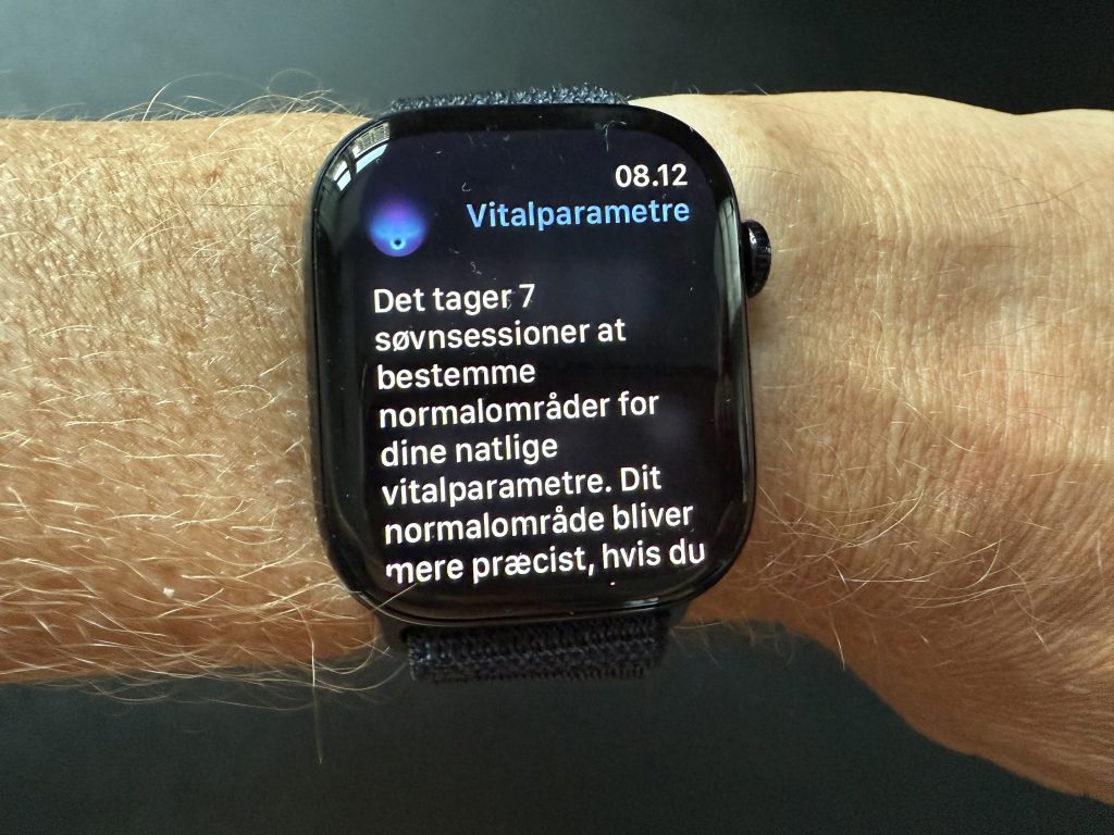 Anmeldelse: Apple Watch Series 10 3 IMG 0092 2