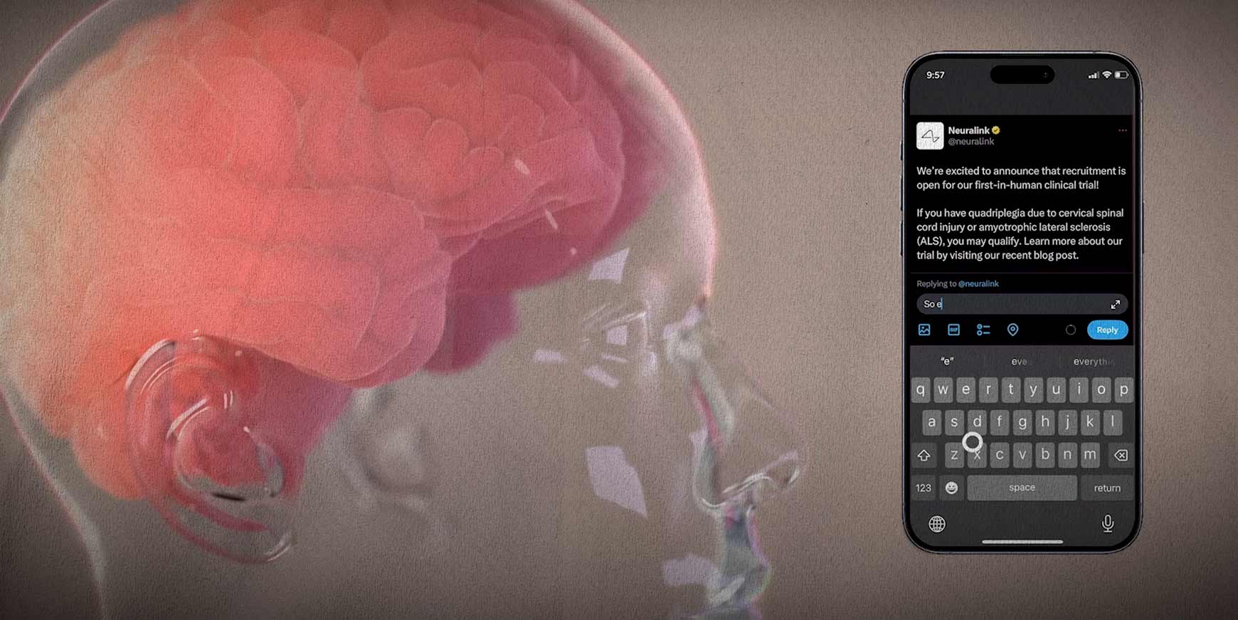 Neuralink vil oversætte dine tanker til tekst 1 neuralink