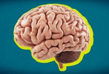 Kunstig intelligens skal forebygge slagtilfælde hos sårbare danskere 5 slagtilfælde